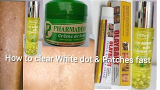 HOW TO CLEAR WHITE DOT / BLEACHING PATCHES IN 7DAY EFFECTIVE RECIPE #whitedot #whitepatches