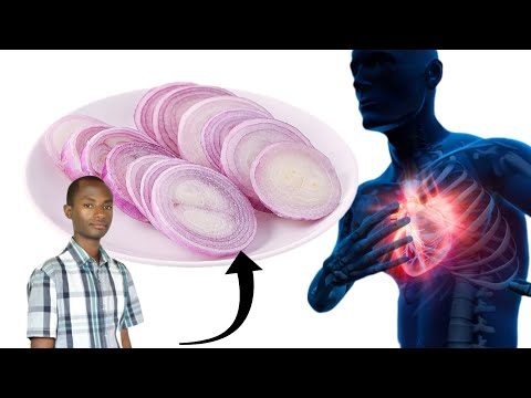 Dore ibintu 11 bitera indwara ya stroke, umuvuduko, n'umutima.