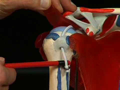 Articulaciones artríticas etapa de tratamiento 2 Dolor de espalda a la izquierda por encima de las causas de la cintura