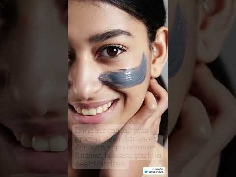 Vidéo : l'acné expliquée par le dermatologue