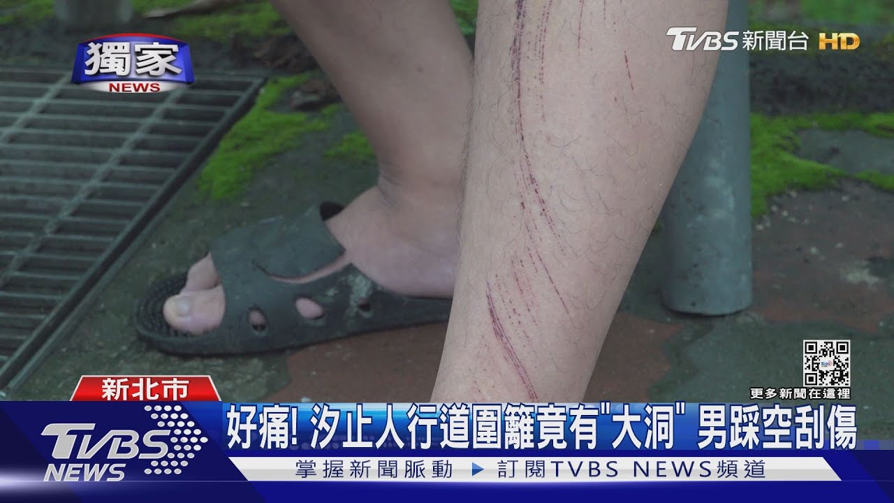 好痛!汐止人行道圍籬竟有「大洞」 男踩空刮傷