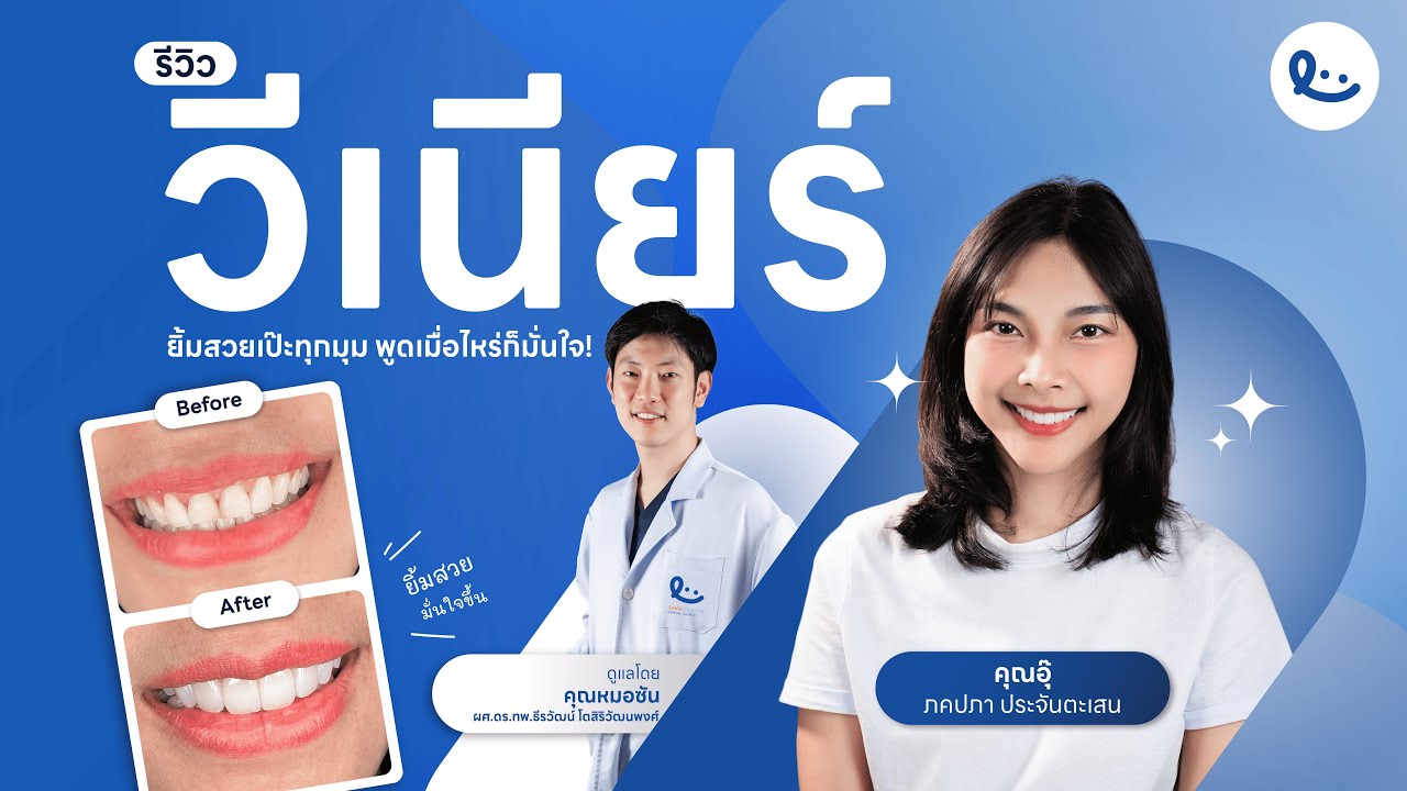 รีวิววีเนียร์ คุณอุ๊