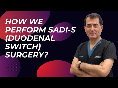 SADI-S (Single Anastomosis Duodeno-ileal Bypass) Animation