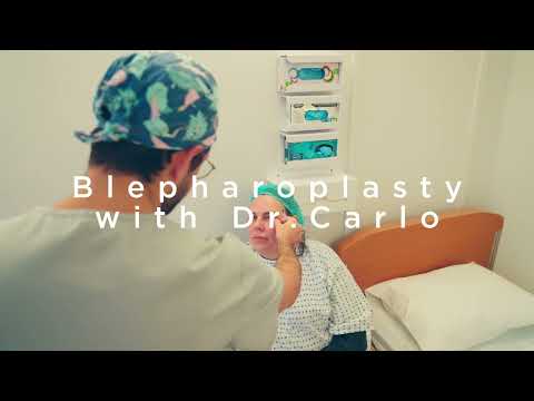 Blepharoplasty with Dr  Carlo at Signature Clinic