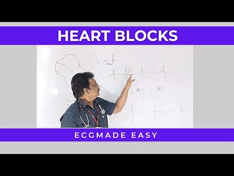 ECG MADE EASY || HEART BLOCKS