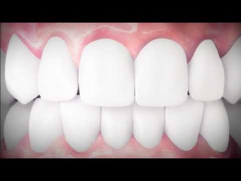 Vicco Vajradanti Herbal ToothPaste for Strong Gums and Healthy Teeth