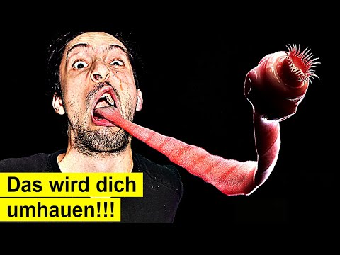 Die schockierende Wahrheit über Parasiten! Niemand hätte es vermutet
