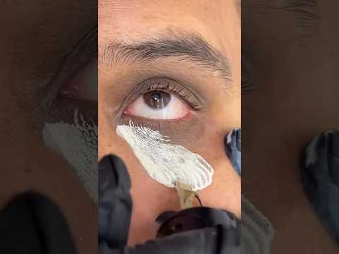 DIY Magical Dark Circles Removal Cream, 3 Days remove Eye wrinkles #darkcircles #beauty #skincare