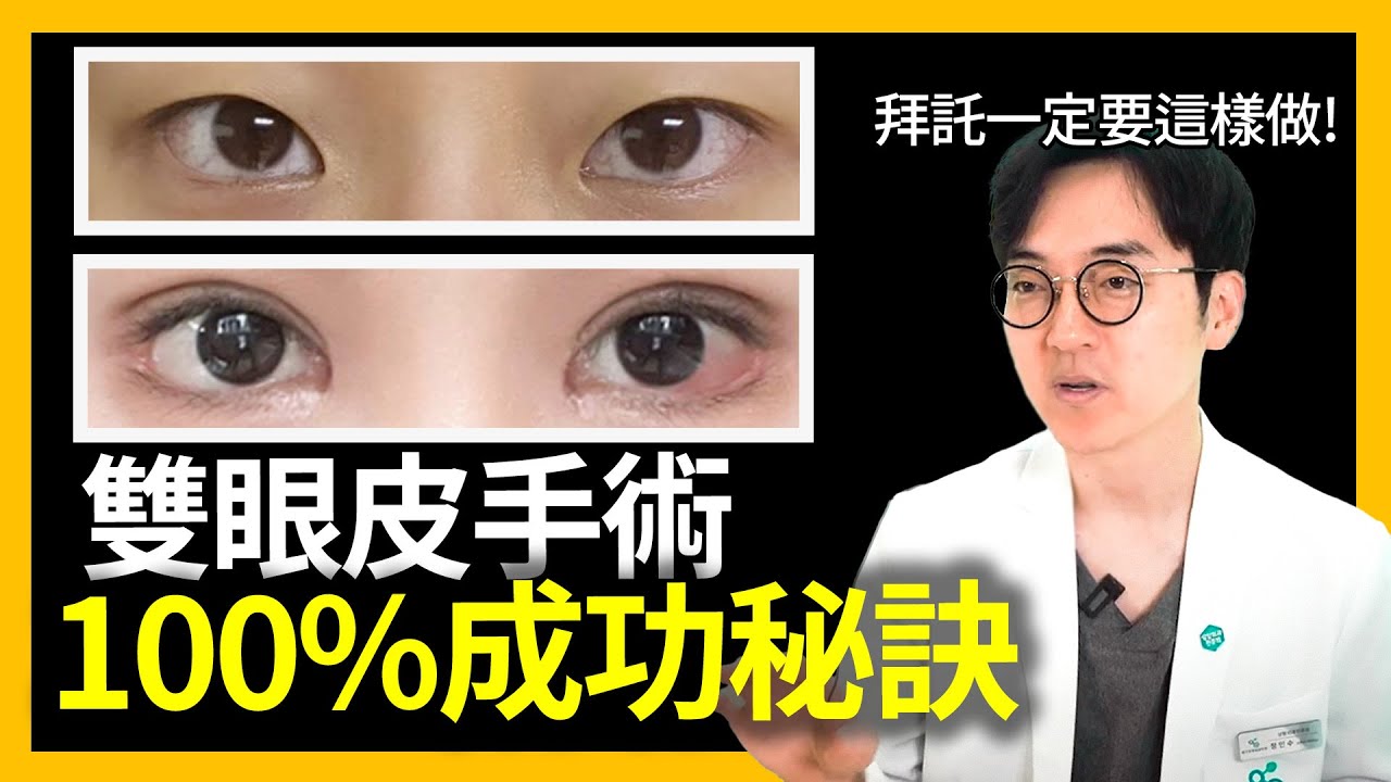 揭開雙眼皮手術的神秘面紗