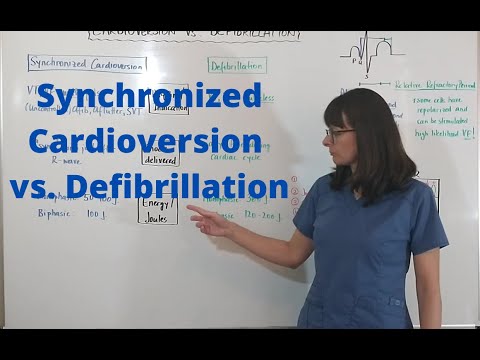 image-What is an unsynchronized shock? 