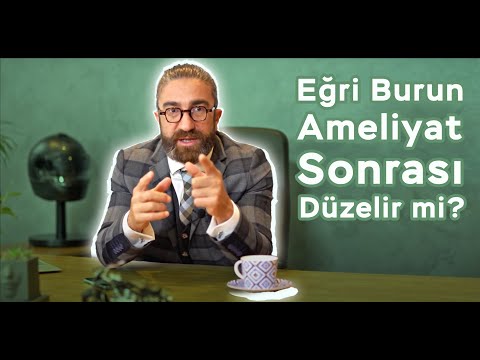 Video 11
