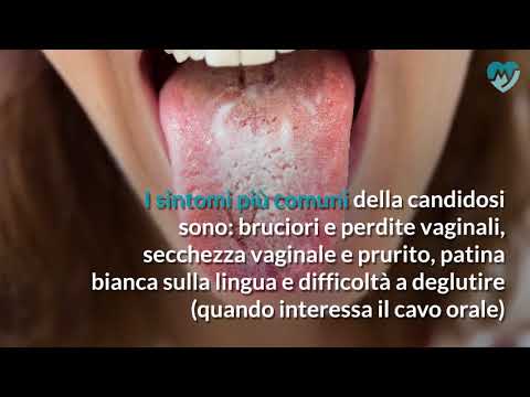 Come lintervento chirurgico dellarticolazione dellanca Guardare lartrosi dellarticolazione del ginocchio