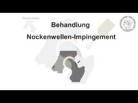 Übungen für Patienten mit Ellbogen Behandlung von Halsschultersyndrom