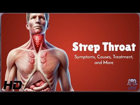 Strep Throat vs. Sore Throat: How to Tell the Difference!