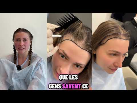 Témoignage patient — vidéo 1