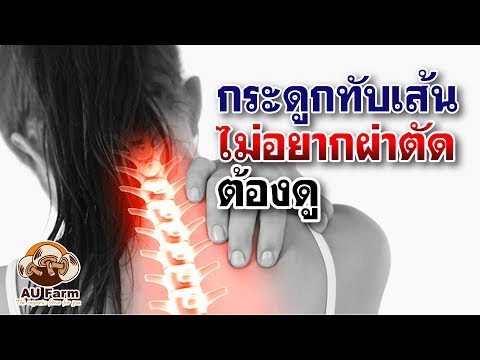 โรคสะเก็ดเงิน Elena Malysheva วิดีโอ Amanitas ของโรคสะเก็ดเงิน