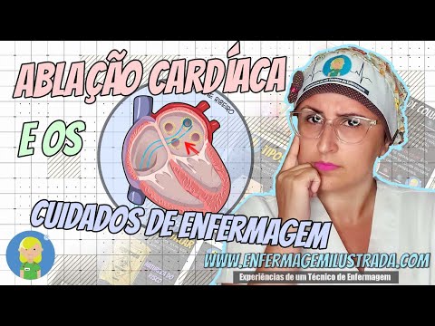 Ablação cardíaca