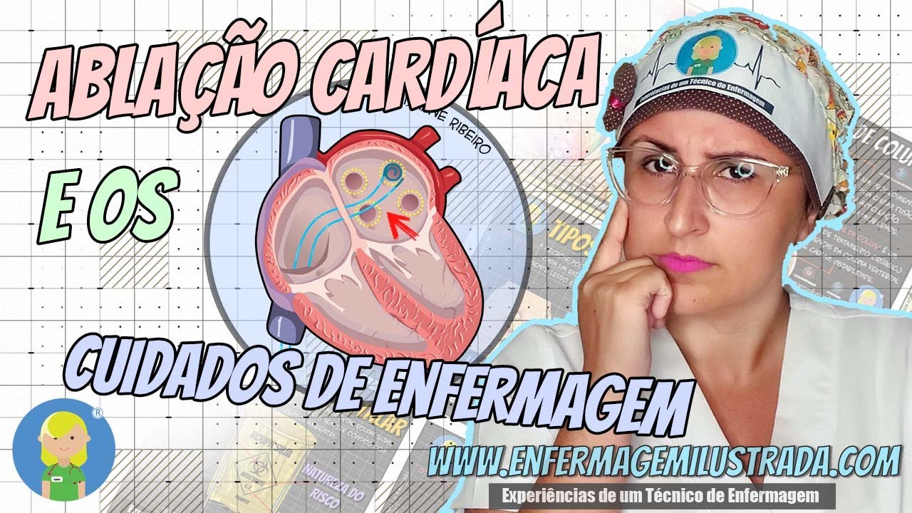 ABLAÇÃO CARDÍACA e os CUIDADOS DE ENFERMAGEM