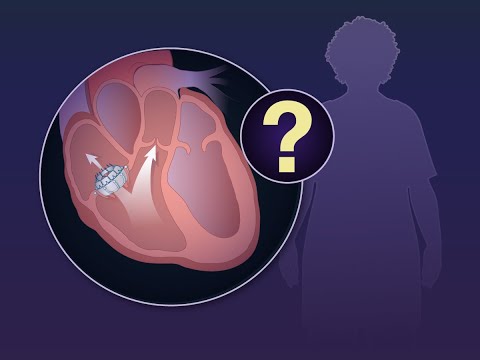 Transcatheter Valve Replacement in Tricuspid Regurgitation | NEJM