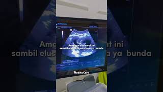 Download lagu Sholawat untuk Janin - Medikacare mp3