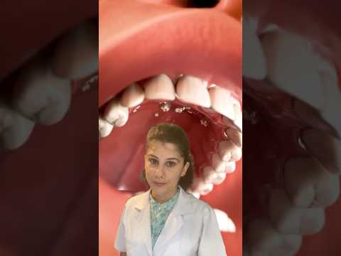 Hyperdontia-condition that causes too many teeth to grow in your mouth🦷🦷. #shorts #dental #viral
