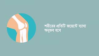 ডেঙ্গু রোগের লক্ষন