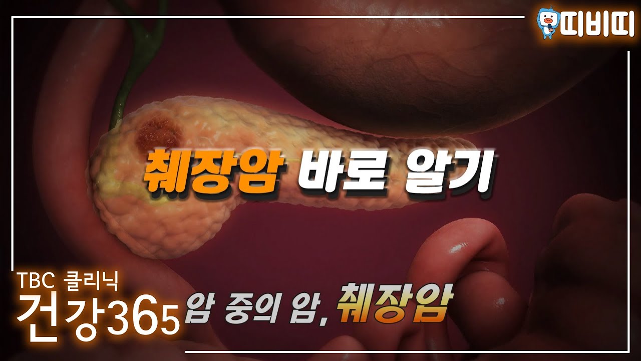 암 중에 암인 췌장암 바로 알기 관련사진