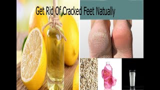 Natural Home remedies for cracked feet/ get your beautiful feet back