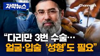 美 언론 모즈타바, 심각한 부상…성형도 필요 보도 [자막뉴스] /채널A