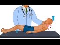 3 Meningitis Tests Nuchal Rigidity Kernig S Brudzinski S Signs Explained