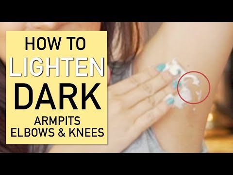 , title : 'How To Lighten Dark Armpits, Elbows and Knees'