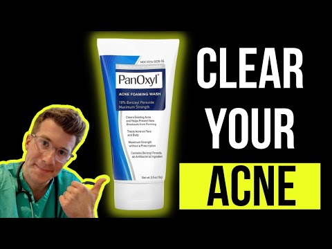 Finished Product Benzoyl Perioxide BENZO 5% GEL, Packaging Size: 20 gm