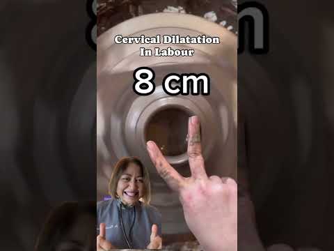 Doctor Explains full cervical Dilatation# pregnancy #labour