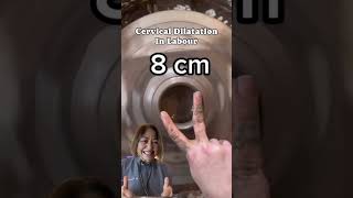 Download lagu Doctor Explains full cervical Dilatation# pregnancy #labour mp3