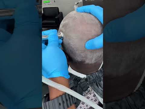 Mega ASMR Bald Head Massage✂️