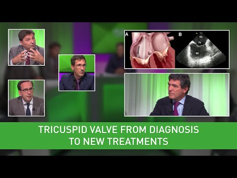 Tricuspid Valve from diagnosis to new treatments - Webinar