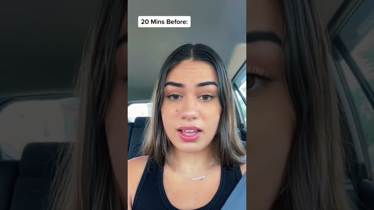 WISDOM TEETH REMOVAL 🤯😂 #shorts