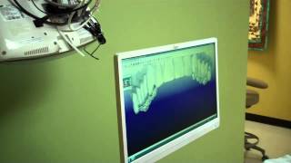 preview picture of video 'Takoma Park Dentist New iTero Technology'