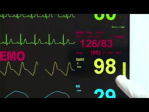 BPL Ultima Prime Series Patient Monitors ECG Machine
