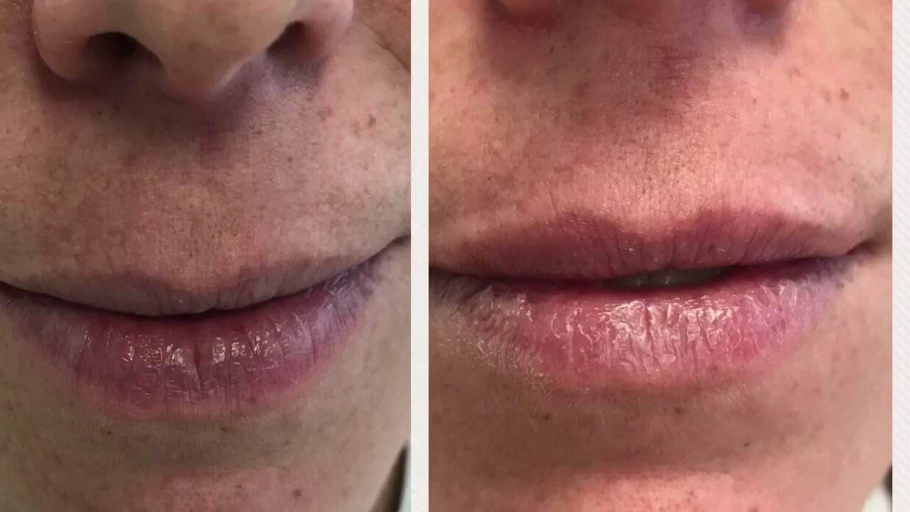 Adriana Pérez García-21