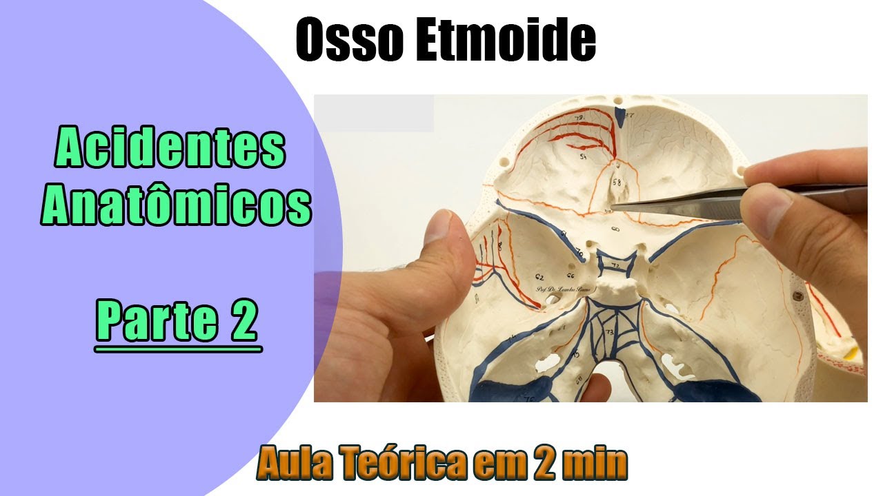 Osso Etmoide - Aula 2 Prática - Anatomia - Anatomia Humana
