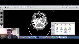 Camada de Anotação