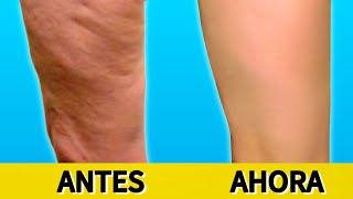CELULITIS EN PIERNAS Y GLÚTEOS | EJERCICIOS PARA DRENAJE LINFÁTICO | FUNCIONA RÁPIDO | NAYLA VLOGS