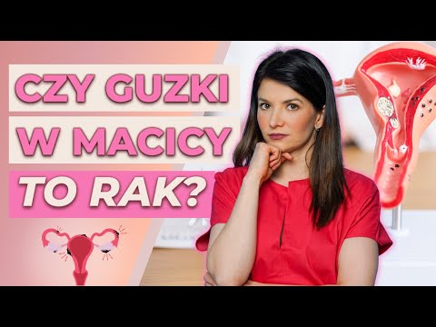 WSZYSTKO, co Musisz Wiedzieć o Mięśniakach Macicy: Objawy, Diagnostyka, Leczenie