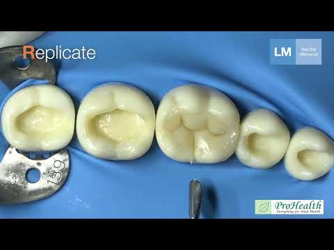 LM-Arte™ Replica Posterior - ProHealth
