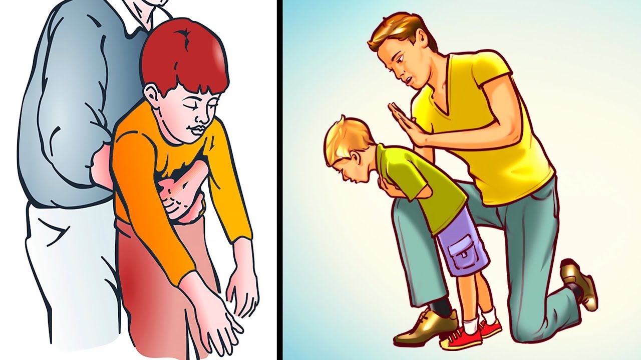 How to Help a Choking Child or Adult (Everyone Must Know!)