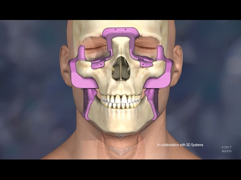 Watch lagu Images Videos Bollywood Plastic Surgery Video, Watch Images Bollywood Plastic Surgery Video free Watchn, video klip Bollywood Plastic Surgery Video