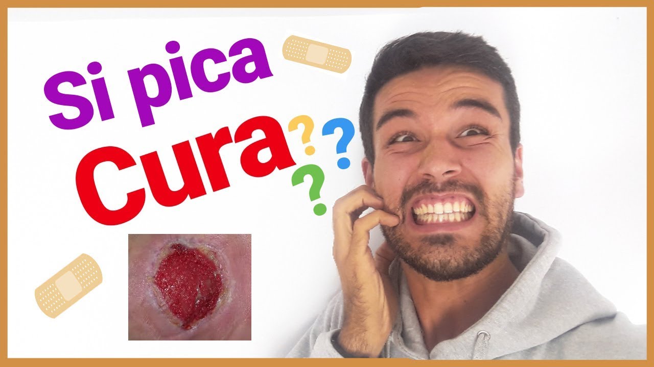 😨 SI PICA CURA