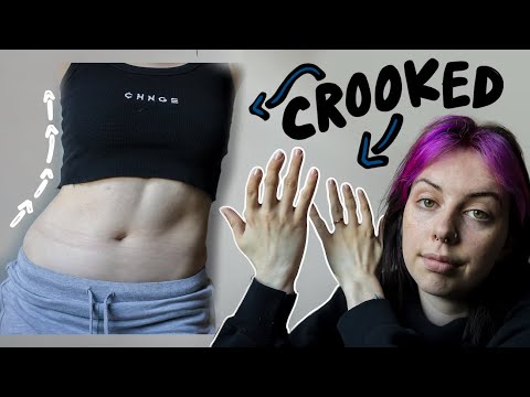 watch this if you feel insecure about yourself. (showing my biggest insecurities)