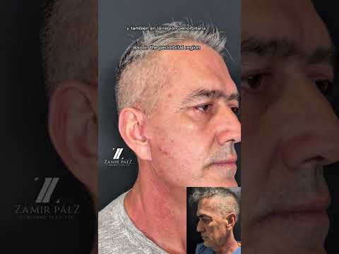 Zamir Páez-240